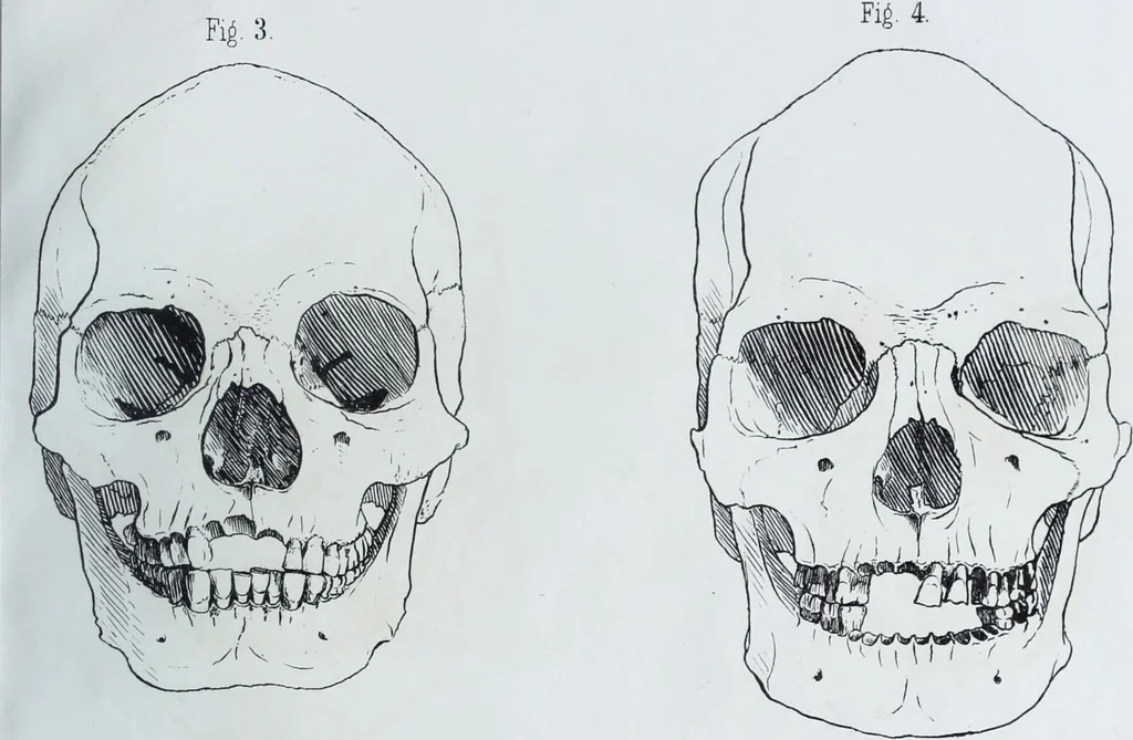 An illustration from Zur Morphologie der Rassen-Schädel : einleitende Bemerkungen und Beiträge, ein Sendschreiben an ... Carl Ernst v. Baer / von Joh. Christ. Gustav Lucae., 1861, leaf 141