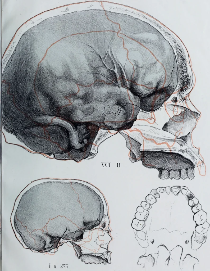 An illustration from Zur Morphologie der Rassen-Schädel : einleitende Bemerkungen und Beiträge, ein Sendschreiben an ... Carl Ernst v. Baer / von Joh. Christ. Gustav Lucae., 1861, leaf 153
