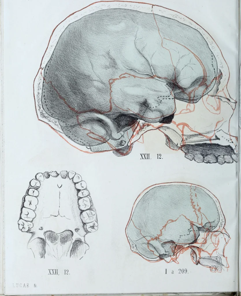 An illustration from Zur Morphologie der Rassen-Schädel : einleitende Bemerkungen und Beiträge, ein Sendschreiben an ... Carl Ernst v. Baer / von Joh. Christ. Gustav Lucae., 1861, leaf 156