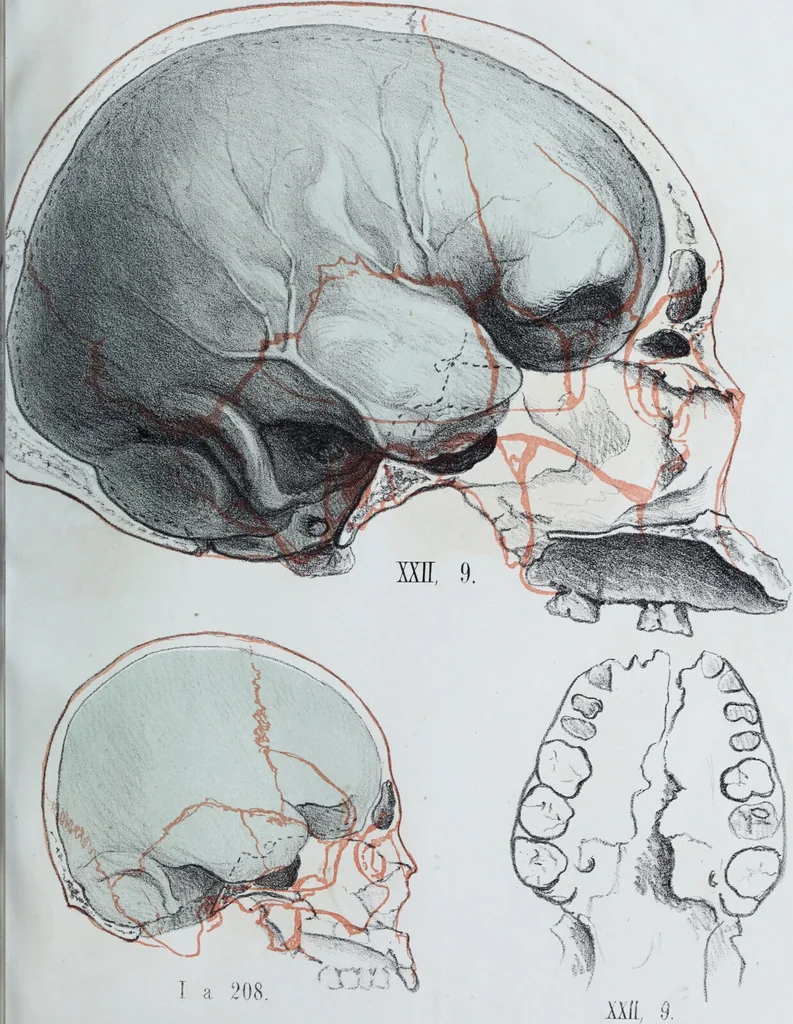 An illustration from Zur Morphologie der Rassen-Schädel : einleitende Bemerkungen und Beiträge, ein Sendschreiben an ... Carl Ernst v. Baer / von Joh. Christ. Gustav Lucae., 1861, leaf 157