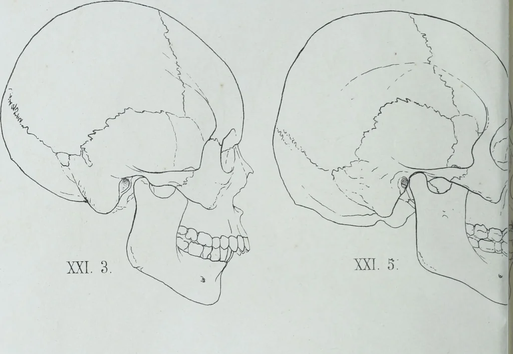 An illustration from Zur Morphologie der Rassen-Schädel : einleitende Bemerkungen und Beiträge, ein Sendschreiben an ... Carl Ernst v. Baer / von Joh. Christ. Gustav Lucae., 1861, leaf 164