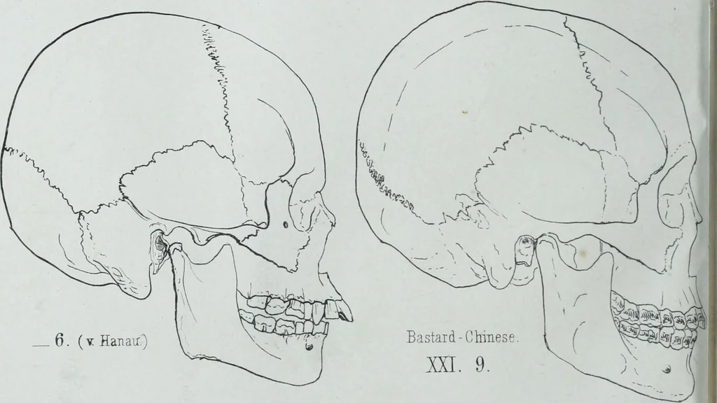 An illustration from Zur Morphologie der Rassen-Schädel : einleitende Bemerkungen und Beiträge, ein Sendschreiben an ... Carl Ernst v. Baer / von Joh. Christ. Gustav Lucae., 1861, leaf 164