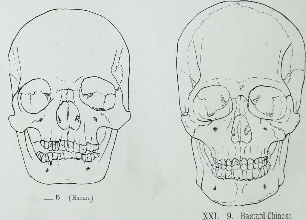 An illustration from Zur Morphologie der Rassen-Schädel : einleitende Bemerkungen und Beiträge, ein Sendschreiben an ... Carl Ernst v. Baer / von Joh. Christ. Gustav Lucae., 1861, leaf 168