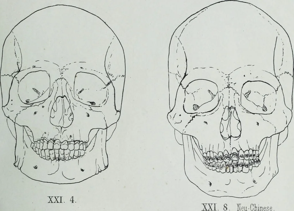 An illustration from Zur Morphologie der Rassen-Schädel : einleitende Bemerkungen und Beiträge, ein Sendschreiben an ... Carl Ernst v. Baer / von Joh. Christ. Gustav Lucae., 1861, leaf 169