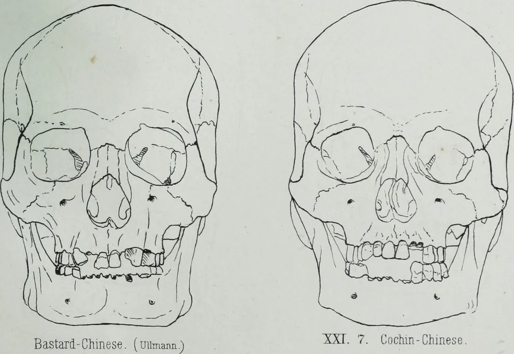An illustration from Zur Morphologie der Rassen-Schädel : einleitende Bemerkungen und Beiträge, ein Sendschreiben an ... Carl Ernst v. Baer / von Joh. Christ. Gustav Lucae., 1861, leaf 169
