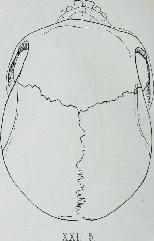 An illustration from Zur Morphologie der Rassen-Schädel : einleitende Bemerkungen und Beiträge, ein Sendschreiben an ... Carl Ernst v. Baer / von Joh. Christ. Gustav Lucae., 1861, leaf 172