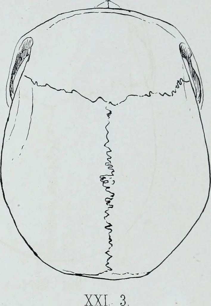 An illustration from Zur Morphologie der Rassen-Schädel : einleitende Bemerkungen und Beiträge, ein Sendschreiben an ... Carl Ernst v. Baer / von Joh. Christ. Gustav Lucae., 1861, leaf 172