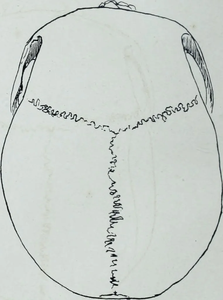 An illustration from Zur Morphologie der Rassen-Schädel : einleitende Bemerkungen und Beiträge, ein Sendschreiben an ... Carl Ernst v. Baer / von Joh. Christ. Gustav Lucae., 1861, leaf 172