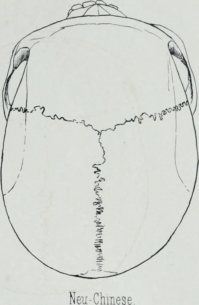 An illustration from Zur Morphologie der Rassen-Schädel : einleitende Bemerkungen und Beiträge, ein Sendschreiben an ... Carl Ernst v. Baer / von Joh. Christ. Gustav Lucae., 1861, leaf 173
