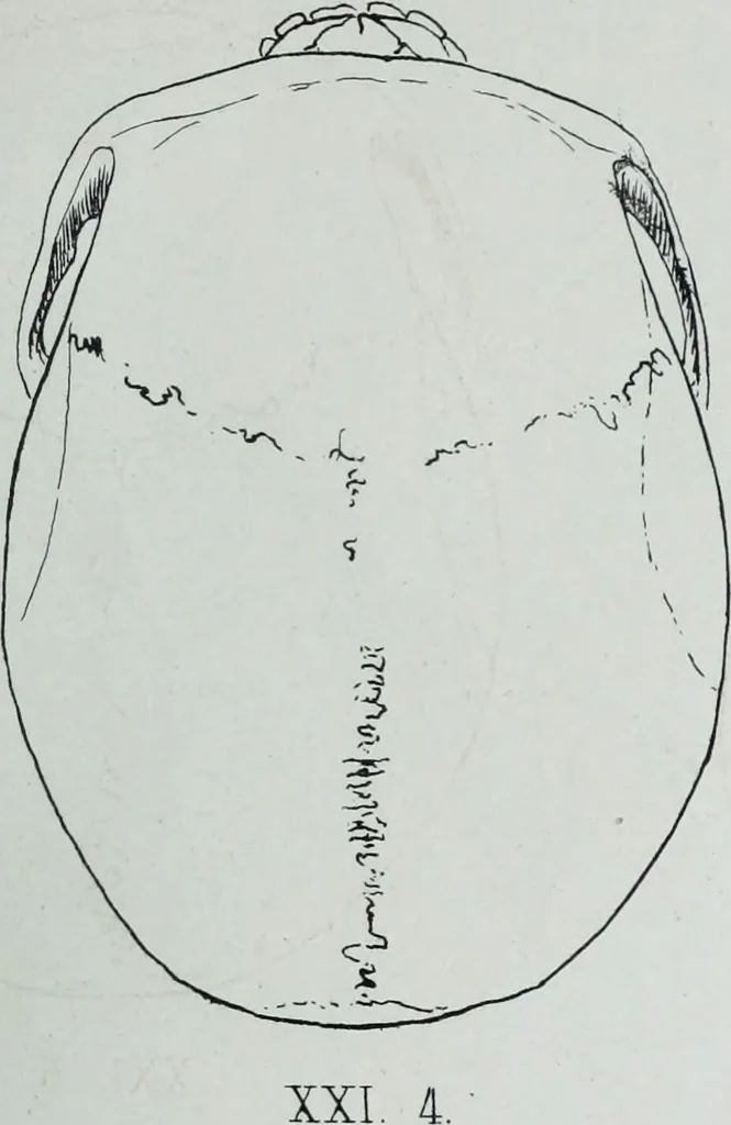 An illustration from Zur Morphologie der Rassen-Schädel : einleitende Bemerkungen und Beiträge, ein Sendschreiben an ... Carl Ernst v. Baer / von Joh. Christ. Gustav Lucae., 1861, leaf 173