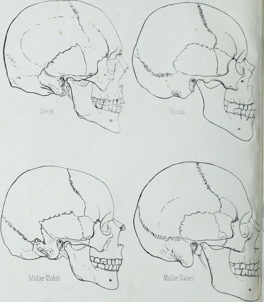 An illustration from Zur Morphologie der Rassen-Schädel : einleitende Bemerkungen und Beiträge, ein Sendschreiben an ... Carl Ernst v. Baer / von Joh. Christ. Gustav Lucae., 1861, leaf 176