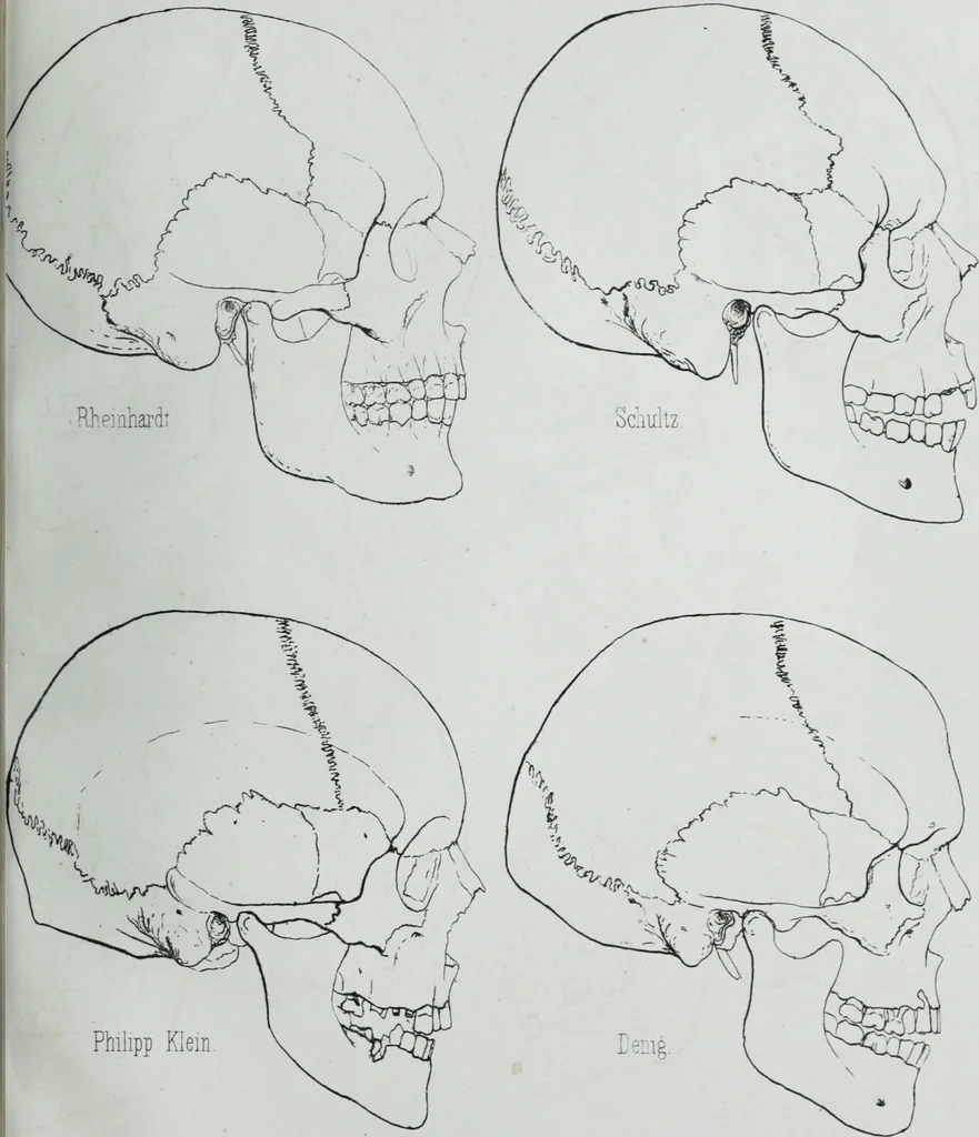 An illustration from Zur Morphologie der Rassen-Schädel : einleitende Bemerkungen und Beiträge, ein Sendschreiben an ... Carl Ernst v. Baer / von Joh. Christ. Gustav Lucae., 1861, leaf 177