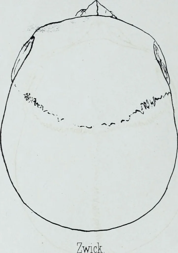 An illustration from Zur Morphologie der Rassen-Schädel : einleitende Bemerkungen und Beiträge, ein Sendschreiben an ... Carl Ernst v. Baer / von Joh. Christ. Gustav Lucae., 1861, leaf 180