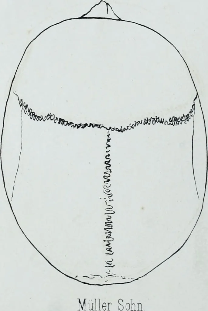 An illustration from Zur Morphologie der Rassen-Schädel : einleitende Bemerkungen und Beiträge, ein Sendschreiben an ... Carl Ernst v. Baer / von Joh. Christ. Gustav Lucae., 1861, leaf 180