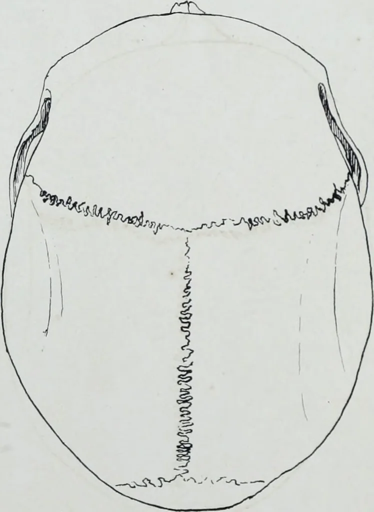 An illustration from Zur Morphologie der Rassen-Schädel : einleitende Bemerkungen und Beiträge, ein Sendschreiben an ... Carl Ernst v. Baer / von Joh. Christ. Gustav Lucae., 1861, leaf 181