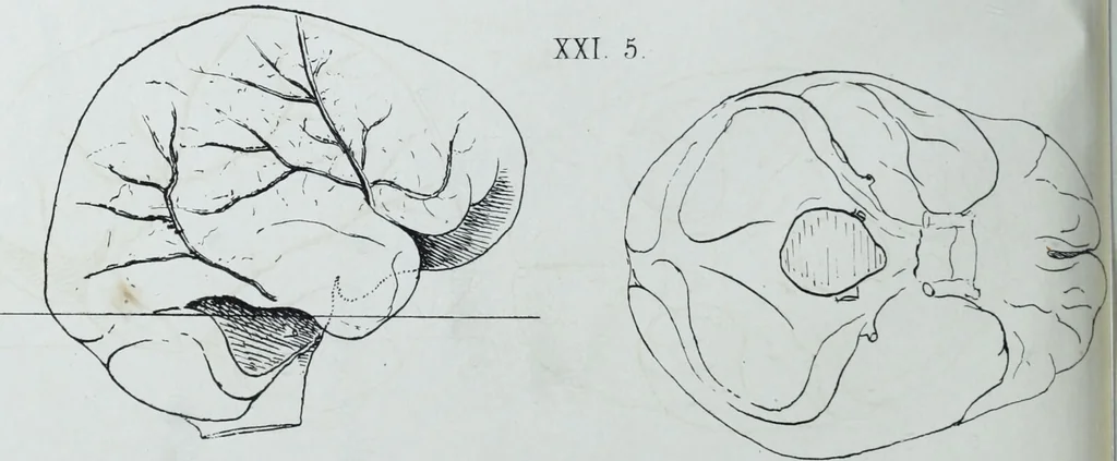 An illustration from Zur Morphologie der Rassen-Schädel : einleitende Bemerkungen und Beiträge, ein Sendschreiben an ... Carl Ernst v. Baer / von Joh. Christ. Gustav Lucae., 1861, leaf 184
