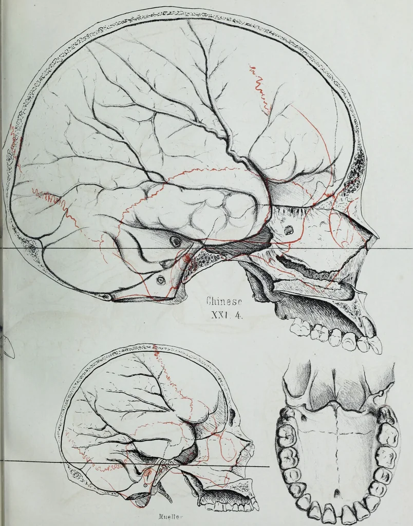 An illustration from Zur Morphologie der Rassen-Schädel : einleitende Bemerkungen und Beiträge, ein Sendschreiben an ... Carl Ernst v. Baer / von Joh. Christ. Gustav Lucae., 1861, leaf 193