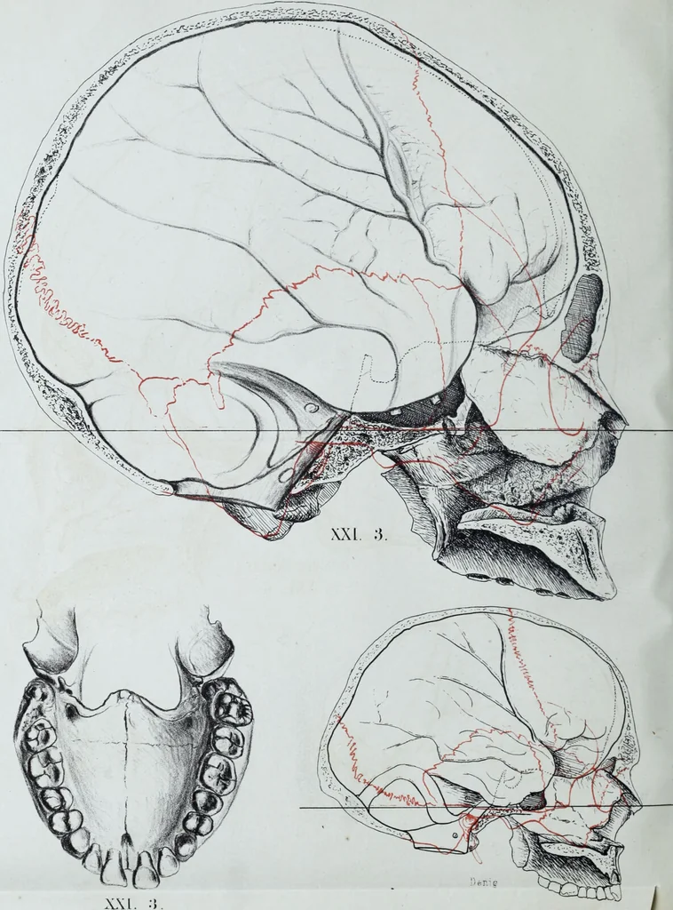 An illustration from Zur Morphologie der Rassen-Schädel : einleitende Bemerkungen und Beiträge, ein Sendschreiben an ... Carl Ernst v. Baer / von Joh. Christ. Gustav Lucae., 1861, leaf 196