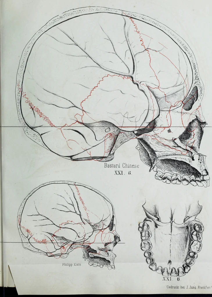 An illustration from Zur Morphologie der Rassen-Schädel : einleitende Bemerkungen und Beiträge, ein Sendschreiben an ... Carl Ernst v. Baer / von Joh. Christ. Gustav Lucae., 1861, leaf 197