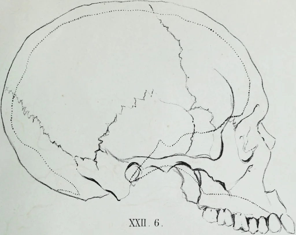 An illustration from Zur Morphologie der Rassen-Schädel : einleitende Bemerkungen und Beiträge, ein Sendschreiben an ... Carl Ernst v. Baer / von Joh. Christ. Gustav Lucae., 1861, leaf 199