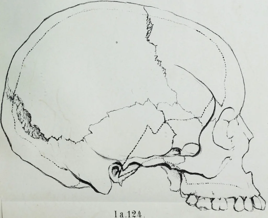 An illustration from Zur Morphologie der Rassen-Schädel : einleitende Bemerkungen und Beiträge, ein Sendschreiben an ... Carl Ernst v. Baer / von Joh. Christ. Gustav Lucae., 1861, leaf 199