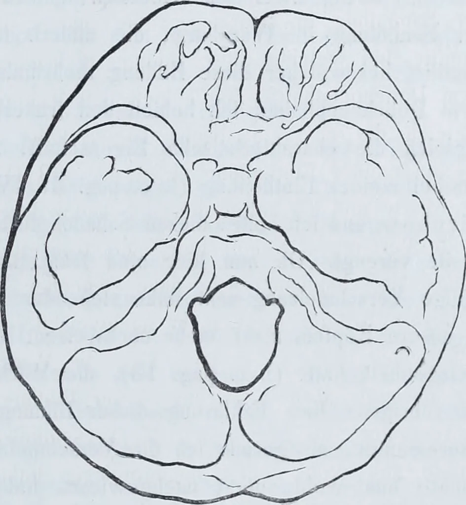 An illustration from Zur Morphologie der Rassen-Schädel : einleitende Bemerkungen und Beiträge, ein Sendschreiben an ... Carl Ernst v. Baer / von Joh. Christ. Gustav Lucae., 1861, leaf 57