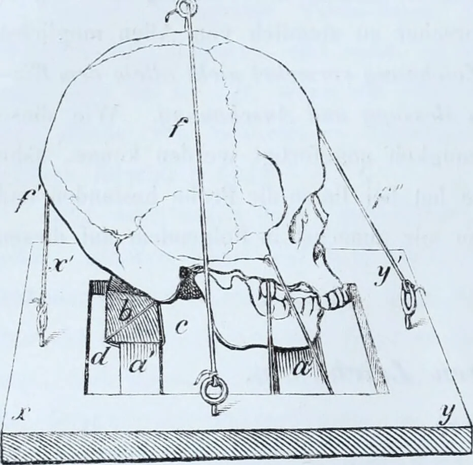 An illustration from Zur Morphologie der Rassen-Schädel : einleitende Bemerkungen und Beiträge, ein Sendschreiben an ... Carl Ernst v. Baer / von Joh. Christ. Gustav Lucae., 1861, leaf 68