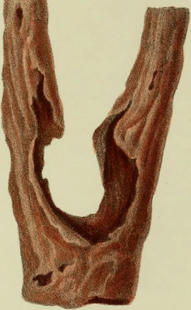 An illustration from Graphic illustrations of abortion and the diseases of menstruation / Consisting of twelve plates from drawings engraved on stone, and coloured by Mr. J. Perry, and two copper-plates from the Philosophical transactions coloured by the same artist : the whole representing forty-five specimens of aborted ova and adventitious productions of the uterus : with preliminary observations, explanations of the figures, and remarks, anatomical and physiological. By A. B. Granville., 1833, leaf 110
