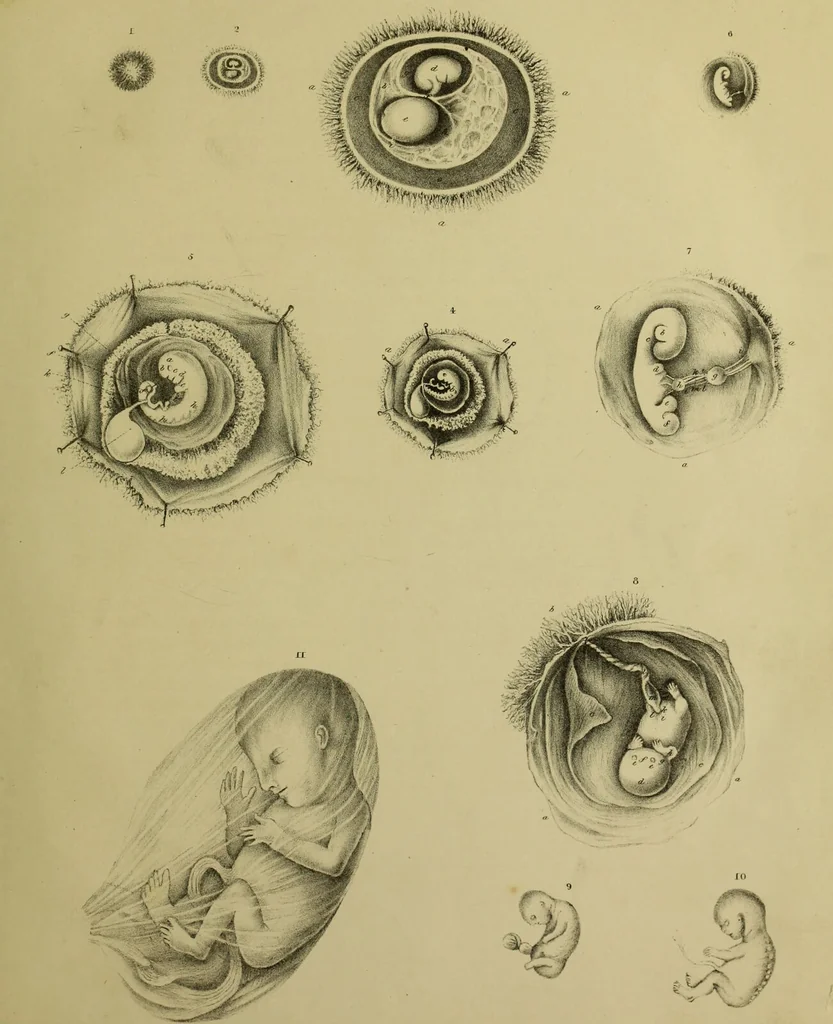 An illustration from Obstetric tables: comprising graphic illustrations, with descriptions and practical remarks; exhibiting on dissected plates many important subjects in midwifery. / By G. Spratt, surgeon-accoucheur., 1843, leaf 27
