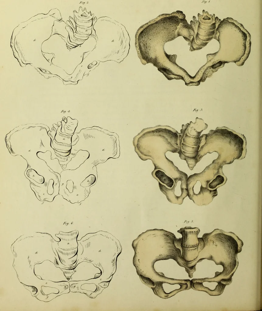 An illustration from Obstetric tables: comprising graphic illustrations, with descriptions and practical remarks; exhibiting on dissected plates many important subjects in midwifery. / By G. Spratt, surgeon-accoucheur., 1843, leaf 60