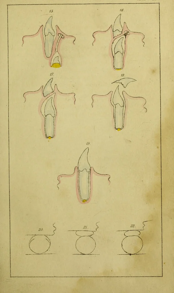 An illustration from On the structure, economy, and pathology of the human teeth, : with careful instructions for their preservation and culture, and concise descriptions of the best modes of surgical treatment, equally adapted to the uses of the medical practitioner, the student in medicine, and of the public. / By William Lintott., 1841, leaf 29