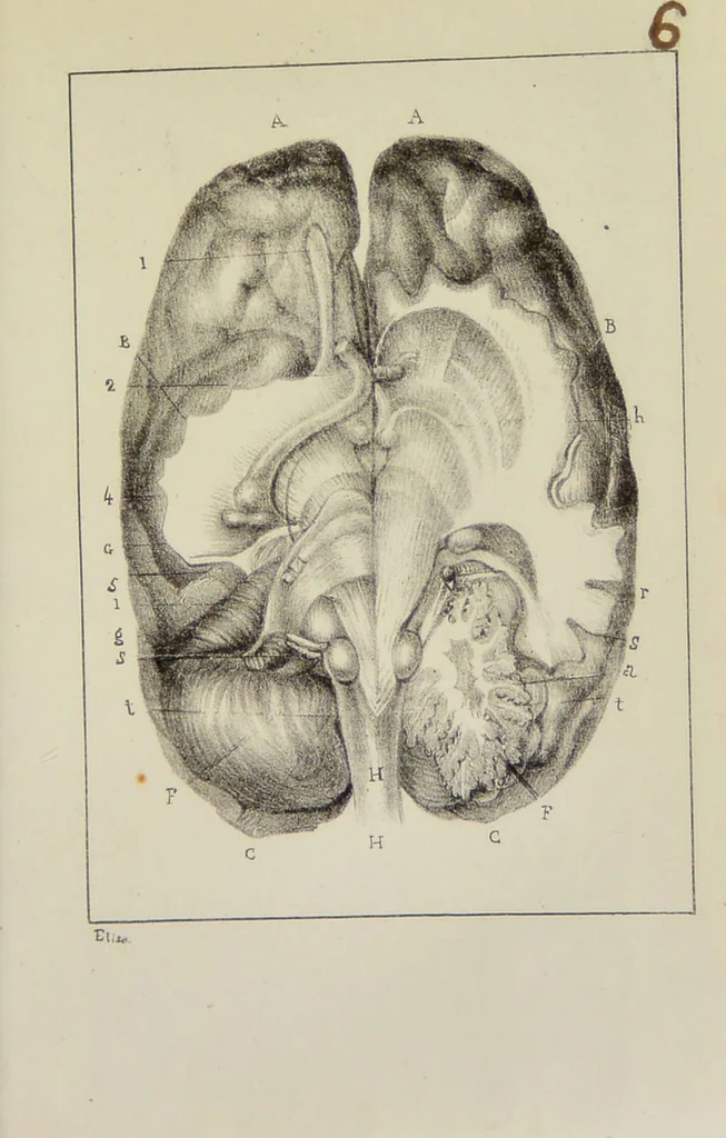 An illustration from Nuevo manual de frenolojía, escrito en inglés ... / puesto en francés con numerosas notas por el Doctor J. Fossati ... y traducido al español por Don José de Garaycoechea., 1840, leaf 339