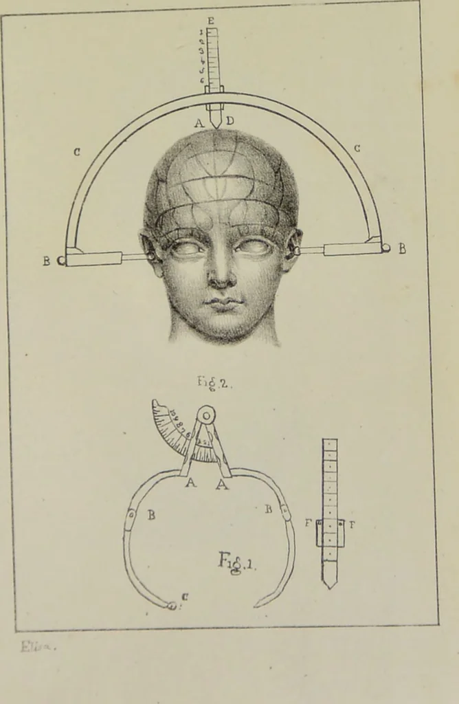 An illustration from Nuevo manual de frenolojía, escrito en inglés ... / puesto en francés con numerosas notas por el Doctor J. Fossati ... y traducido al español por Don José de Garaycoechea., 1840, leaf 341