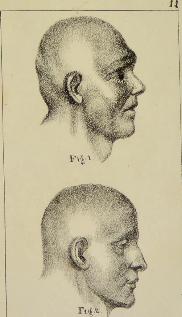 An illustration from Nuevo manual de frenolojía, escrito en inglés ... / puesto en francés con numerosas notas por el Doctor J. Fossati ... y traducido al español por Don José de Garaycoechea., 1840, leaf 355
