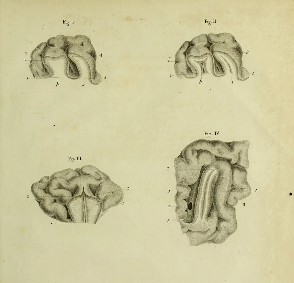 An illustration from Recherches sur le système nerveux en général, et sur celui du cerveau en particulier; mémoire présenté à l'Institut de France, le 14 mars 1808; suivi d'observations sur le rapport qui en a été faite à cette compagnie par ses commissaires / Par F.J. Gall et G. Spurzheim., 1809, leaf 295