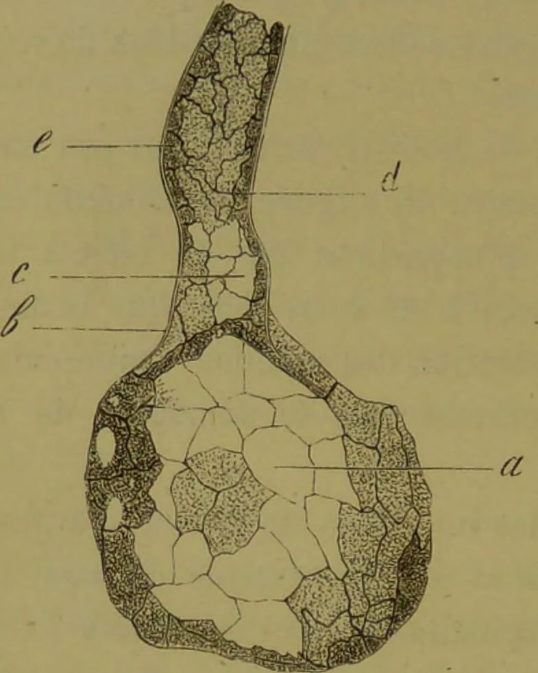 An illustration from Étude du processus histologique des néphrites / par Ch. Hortolès ; avec quatre gravures dans le texte et cinq planches chromolithographiées par M. Gouget., 1881, leaf 50