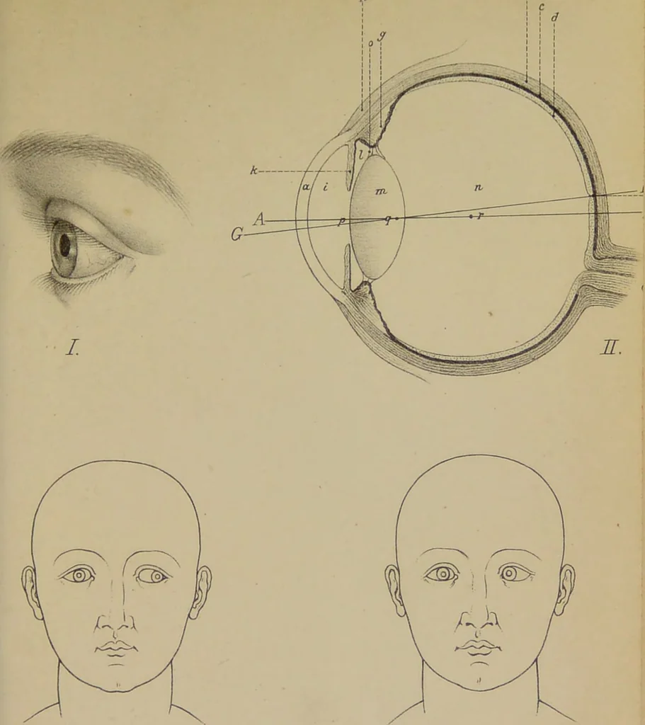 An illustration from Der Ausdruck im Auge und Blick : Vortrag gehalten in Marburg am 2. Februar 1876 / von Herm. Schmidt-Rimpler., 1876, leaf 45