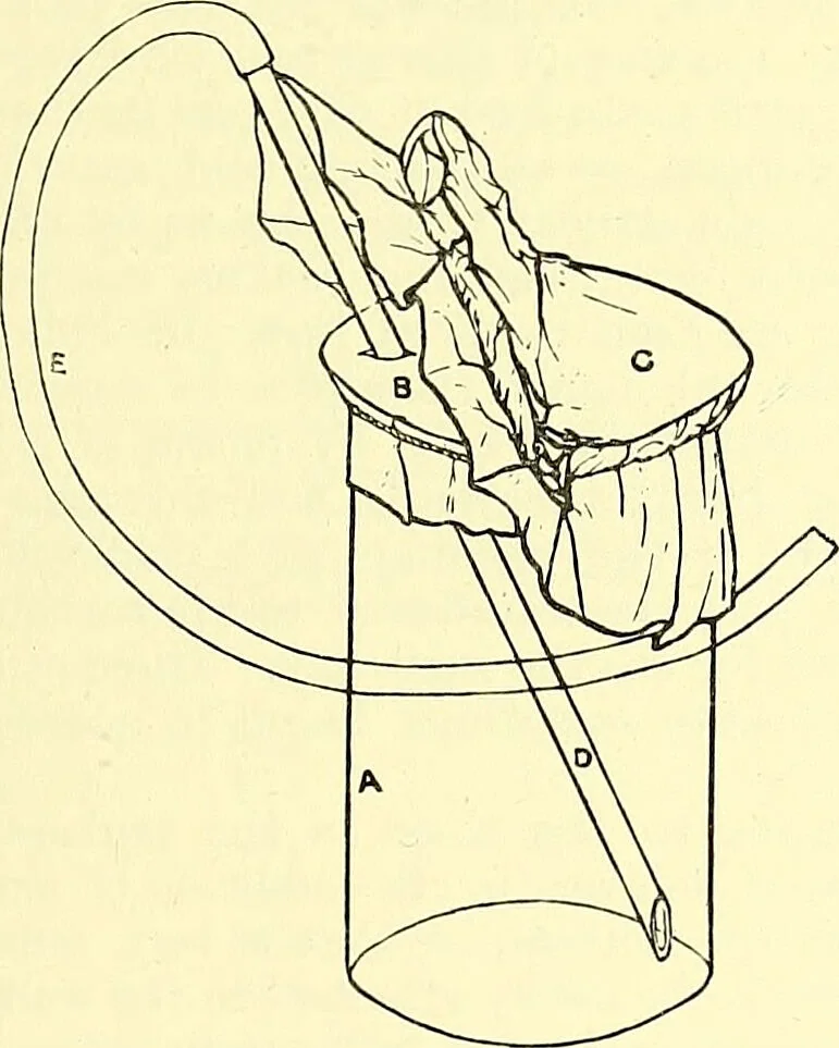 An illustration from Report on the bacteriological diagnosis and the antitoxic serum treatment of cases admitted to the hospitals of the Board during the years 1895 and 1896. / By G. Sims Woodhead., 1899, leaf 145