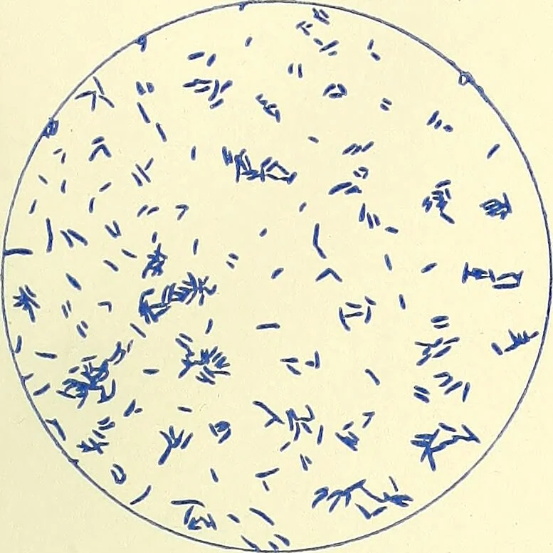 An illustration from Report on the bacteriological diagnosis and the antitoxic serum treatment of cases admitted to the hospitals of the Board during the years 1895 and 1896. / By G. Sims Woodhead., 1899, leaf 31