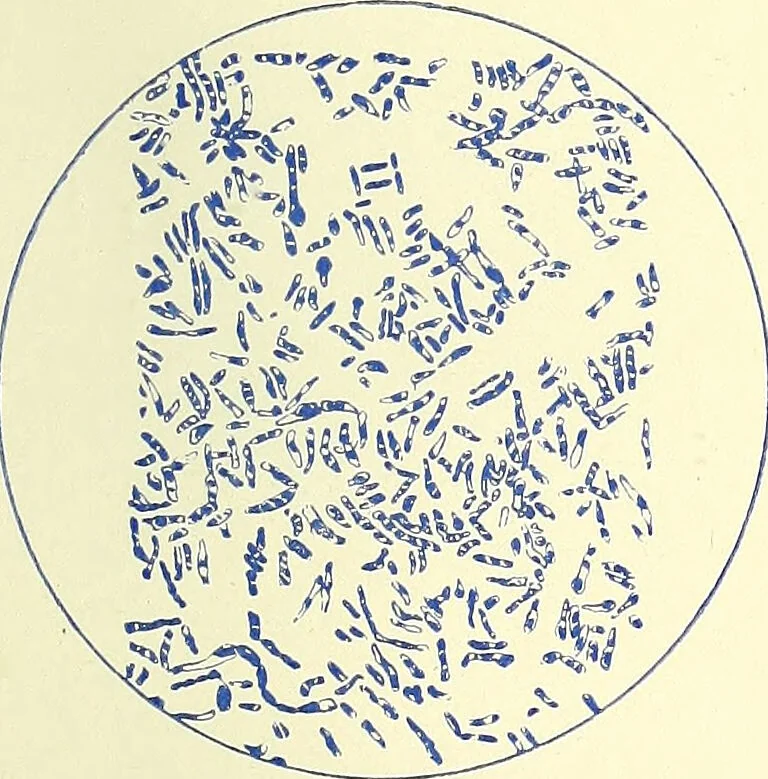 An illustration from Report on the bacteriological diagnosis and the antitoxic serum treatment of cases admitted to the hospitals of the Board during the years 1895 and 1896. / By G. Sims Woodhead., 1899, leaf 31
