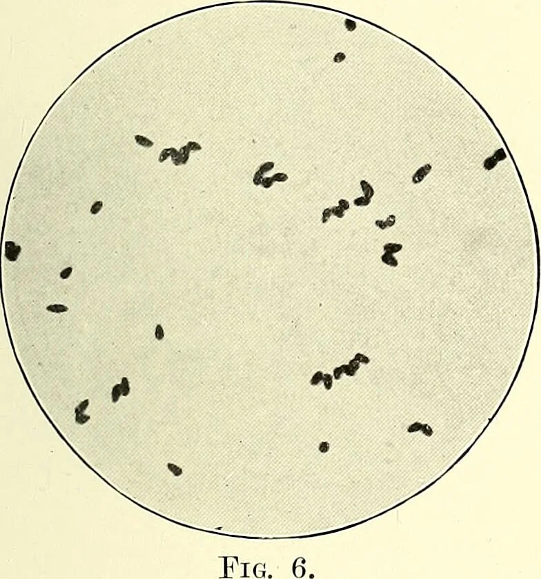 An illustration from Report on the bacteriological diagnosis and the antitoxic serum treatment of cases admitted to the hospitals of the Board during the years 1895 and 1896. / By G. Sims Woodhead., 1899, leaf 33