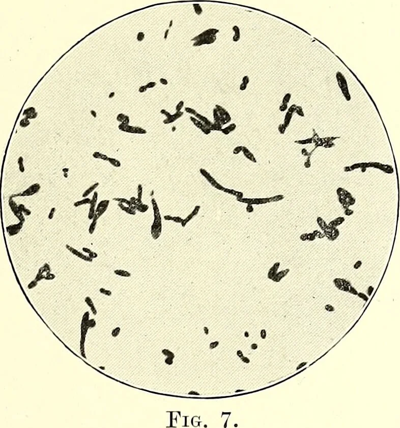 An illustration from Report on the bacteriological diagnosis and the antitoxic serum treatment of cases admitted to the hospitals of the Board during the years 1895 and 1896. / By G. Sims Woodhead., 1899, leaf 33