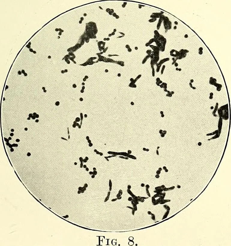 An illustration from Report on the bacteriological diagnosis and the antitoxic serum treatment of cases admitted to the hospitals of the Board during the years 1895 and 1896. / By G. Sims Woodhead., 1899, leaf 33