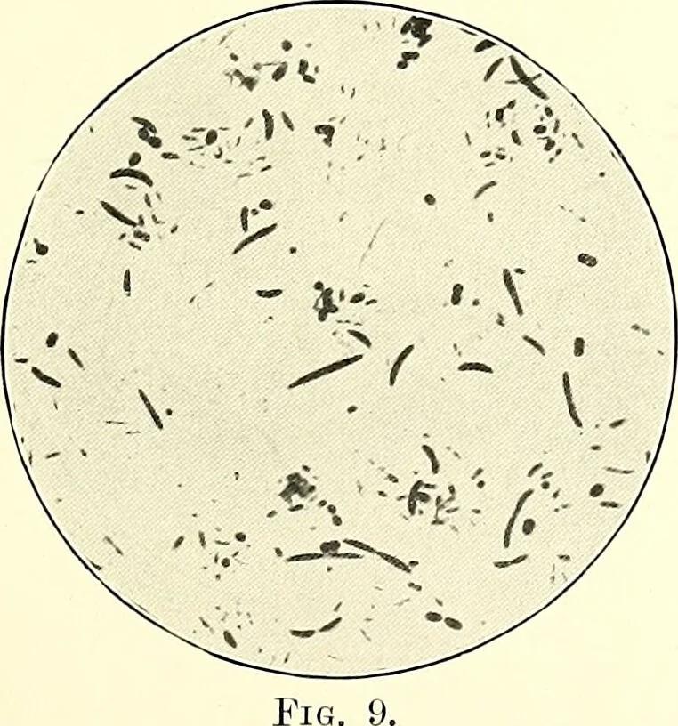 An illustration from Report on the bacteriological diagnosis and the antitoxic serum treatment of cases admitted to the hospitals of the Board during the years 1895 and 1896. / By G. Sims Woodhead., 1899, leaf 33