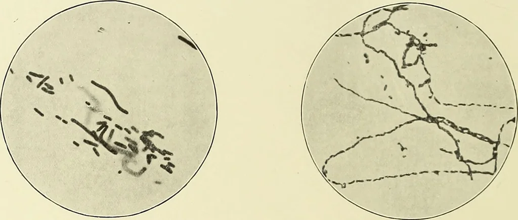 An illustration from Report on the bacteriological diagnosis and the antitoxic serum treatment of cases admitted to the hospitals of the Board during the years 1895 and 1896. / By G. Sims Woodhead., 1899, leaf 34