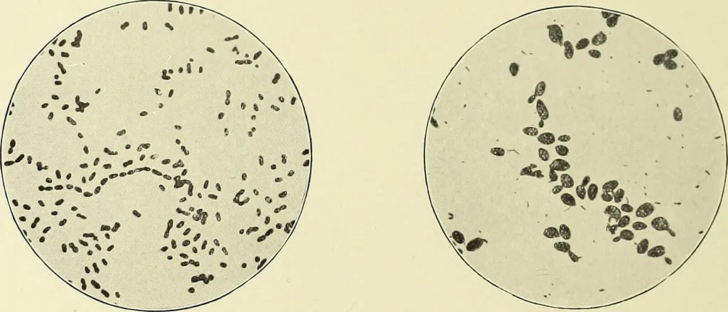 An illustration from Report on the bacteriological diagnosis and the antitoxic serum treatment of cases admitted to the hospitals of the Board during the years 1895 and 1896. / By G. Sims Woodhead., 1899, leaf 34