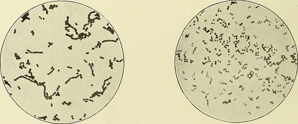 An illustration from Report on the bacteriological diagnosis and the antitoxic serum treatment of cases admitted to the hospitals of the Board during the years 1895 and 1896. / By G. Sims Woodhead., 1899, leaf 34