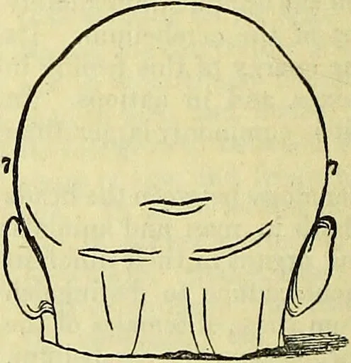 An illustration from Outlines of phrenology / by the late J.G. Spurzheim., 1844, leaf 10