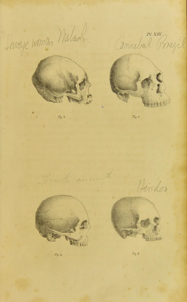 An illustration from Phrenology, in connexion with the study of physiognomy / by G. Spurzheim., 1826, leaf 83