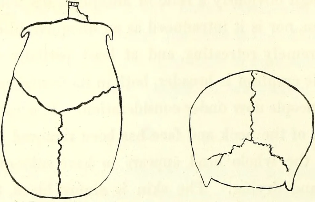 An illustration from Crania americana or, A comparative view of the skulls of various aboriginal nations of North and South America : to which is prefixed an essay on the varities of the human species / by Samuel George Morton., 1839, leaf 128